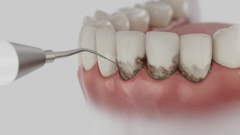 Trusted Tooth Extraction service in Flat Rock, MI - Dentist Open Now
